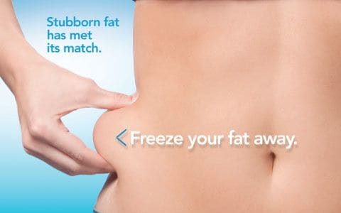 Hips treatment Bletchley From Lipo Sculpt
