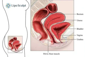 Treatment For A Leaky Bladder 2 How EM Chair treatment Bletchley can help Leaky bladder issues. Read more now!