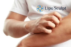 Best Actinic Keratoses Removal 4 prevent your actinic keratoses Bletchley getting worse - call our team today!