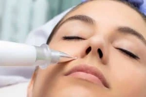 Best Actinic Keratoses Removal 3 Actinic keratoses Bletchley solutions - book in today!