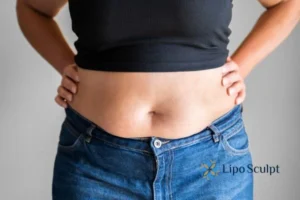 Bidding Farewell to Muffin Tops with Aqualyx Fat Injections 2 Do you wish you could reduce your muffin top Bletchley With Aqualy fat dissolving injections you can!